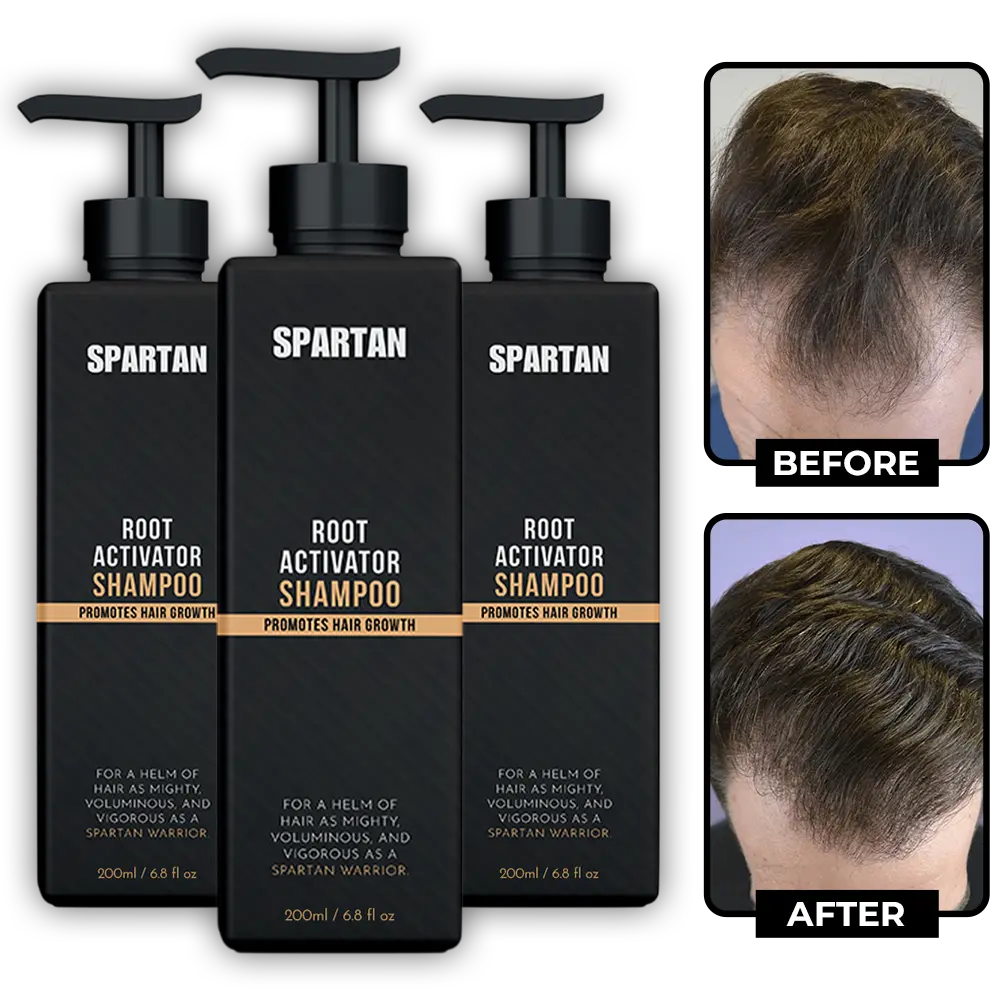 shampoing Spartan Root Activator