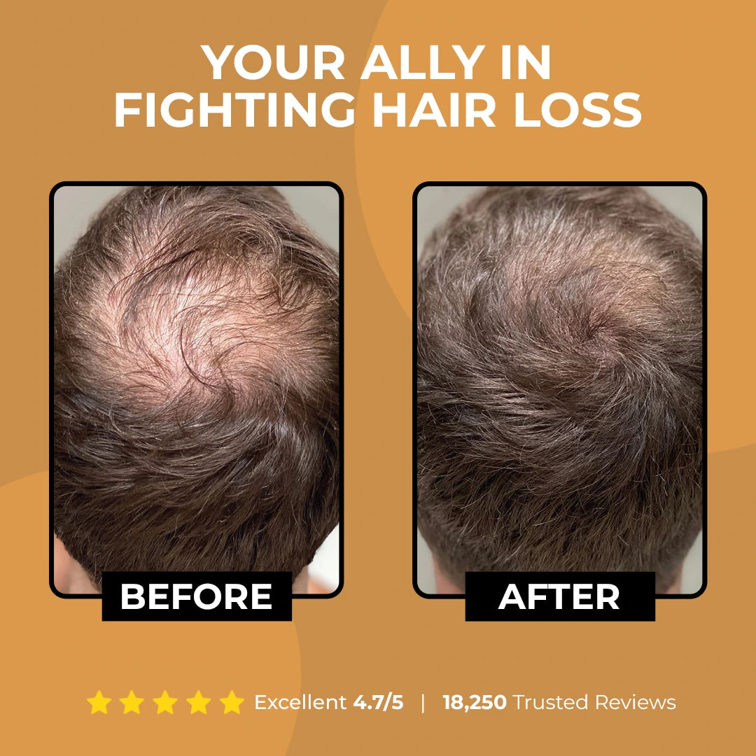 shampoing Spartan Root Activator