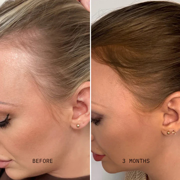 Oilogy Dermapulse™